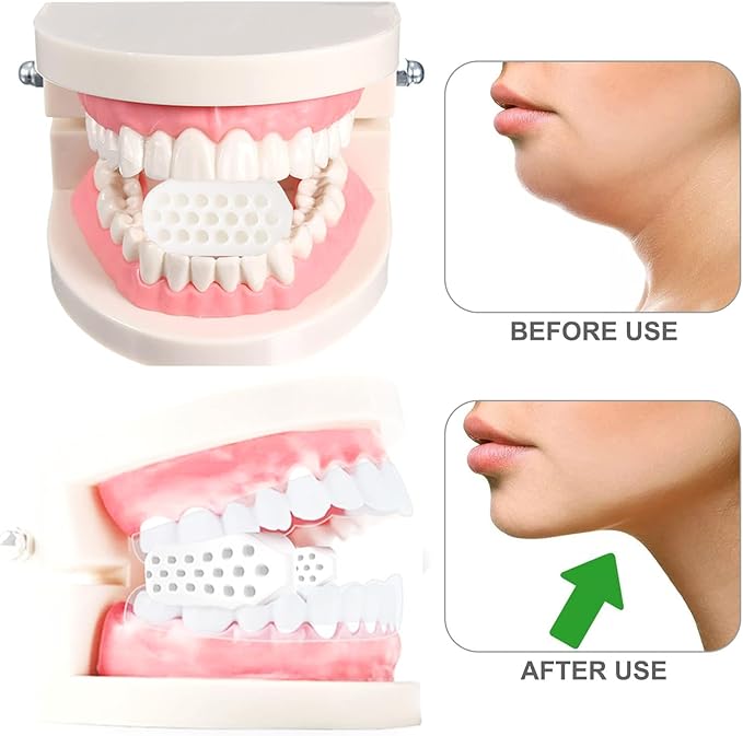 Jaw Trainer